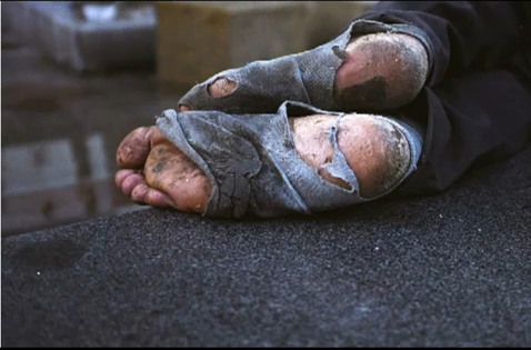 homelessness-feet